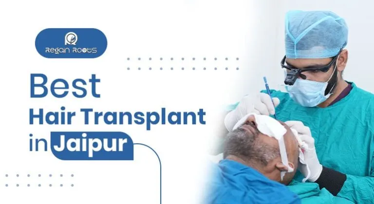 best hair transplant in jaipur