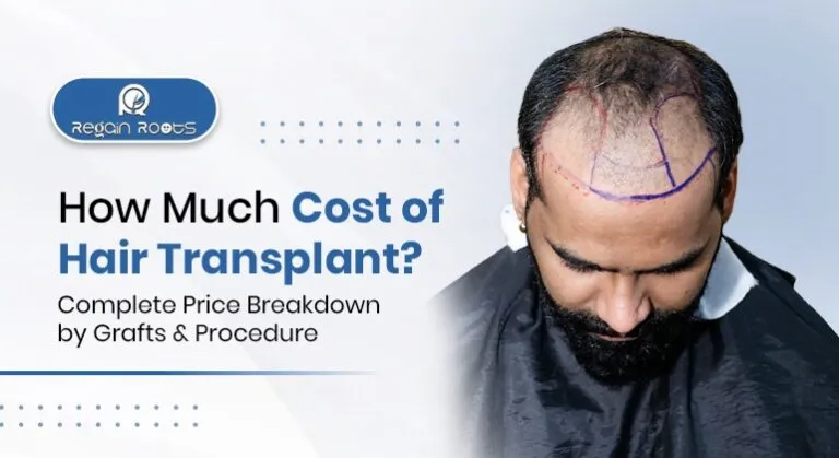 How Much Does a Hair Transplant Cost? Complete Price Breakdown by Grafts & Procedure